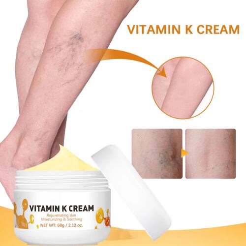 Vitamin K Cream Anti-aging And Wrinkle Removal Varicose Vein