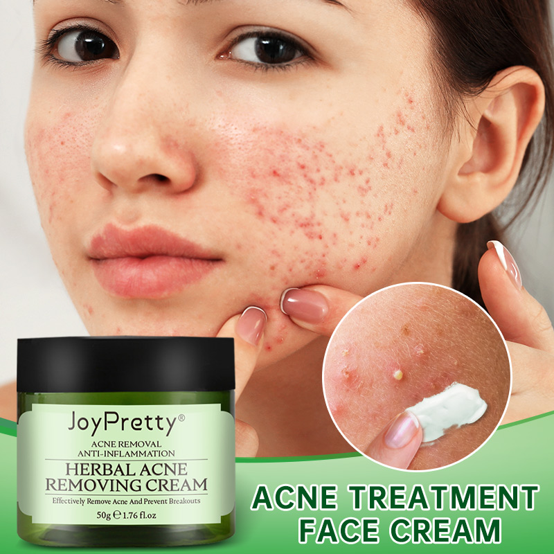 Acne Face Cream Herbal Pimple Scar Removal Shrink Pore Oil C 彩妆/香水/美妆工具 化妆/美容工具 原图主图