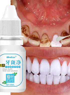Teeth Whitening Serum Cleans Mouth Freshens Breath Essence