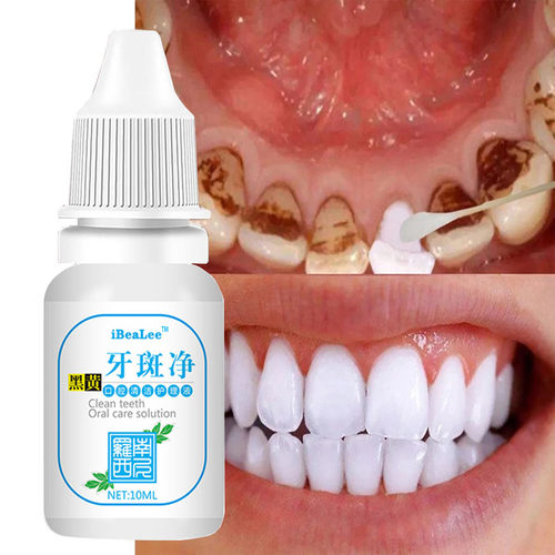 TeethWhiteningSerumCleans