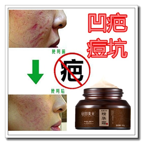 祛除凹陷疤痕平肌快速生长有效淡化痘坑去凹坑痤疮坑凹洞痘疤痕灵