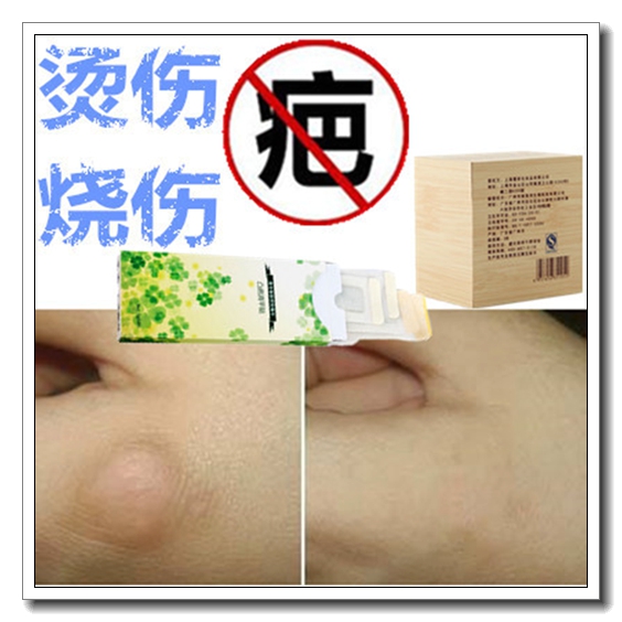 去除前胸痤疮黑色素巴痕皮肤软膏抗疤痕增生针祛儿童脸部烫伤喷剂