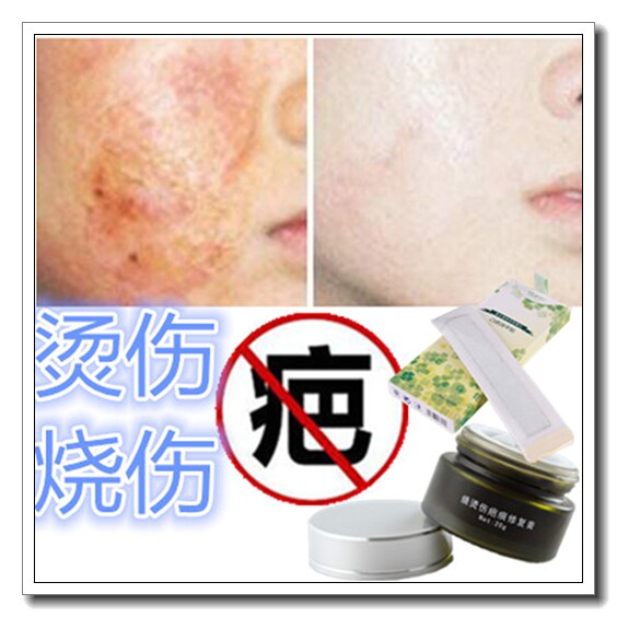 祛除刨妇产增生正品烧伤疤痕软膏烫伤遮盖神器去眼角抓伤凸起疙瘩