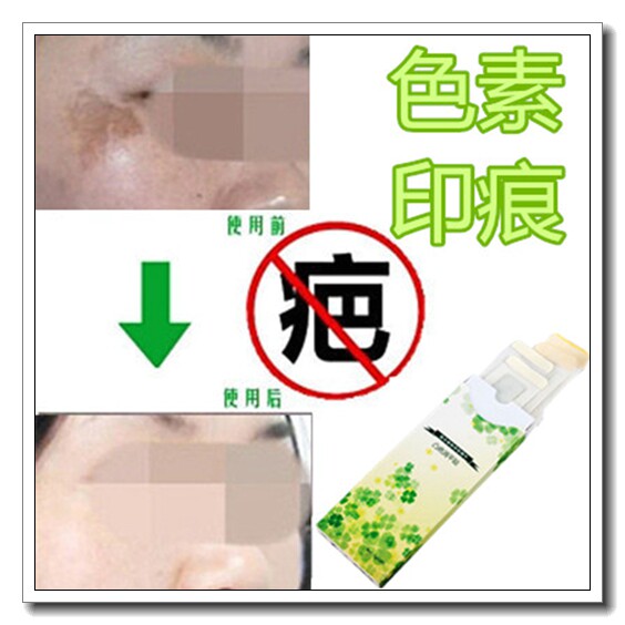 淡化脸部黑印面霜修护膏去除男女抓伤色素印痕抑制黑色素沉着回流