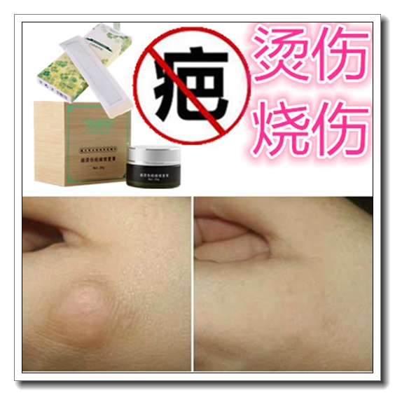 防止烫烧伤疤痕增生贴敷料止痛膏药促黑色素手术伤痕修复伤口消疤