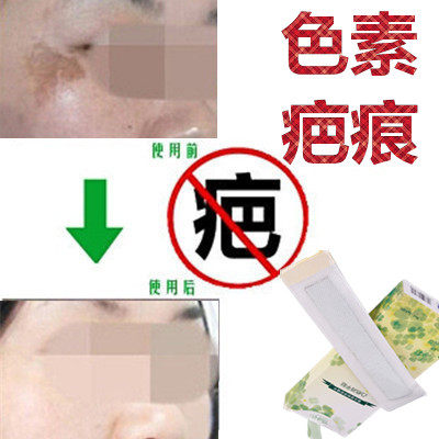 淡化抓痕黑印痘疤痕去除手术后黑色素沉淀回流祛男女色素印痕沉着