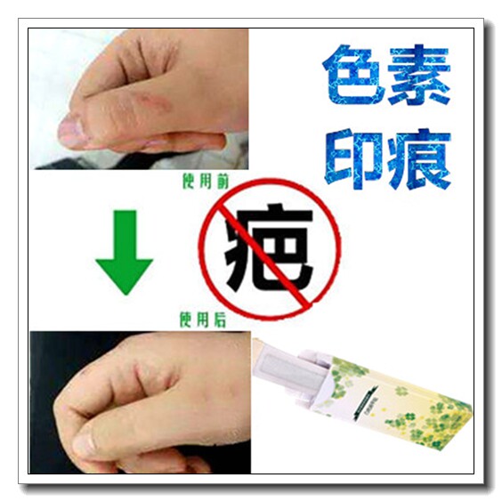 草本祛黑色素沉着回流色素印痕霜淡化抓痕黑印红印产品正品药膏贴
