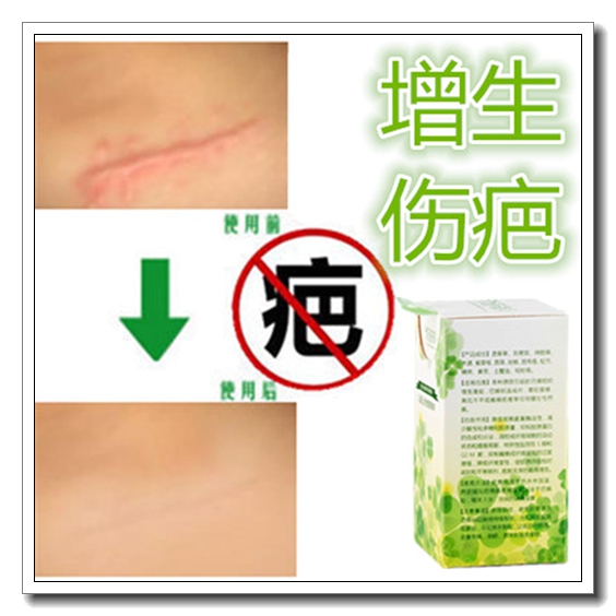去除脸面部擦伤摔伤护理药膏淡化凹凸起疤痕灵愈合黑色素儿童专用