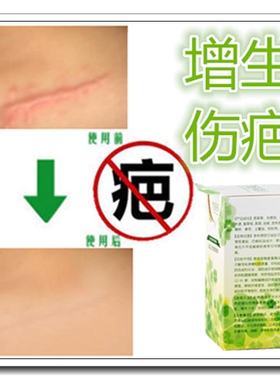 去除脸面部擦伤摔伤护理药膏淡化凹凸起疤痕灵愈合黑色素儿童专用