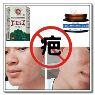 去手术修复增生性突疤疙瘩破腹产伤疤痕印激光缝针抓伤色素沉着疤