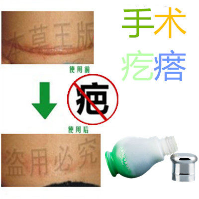 祛手术后撞伤缝针药膏修复液去除增生性突起疙瘩刀伤巴痕烟疤产品