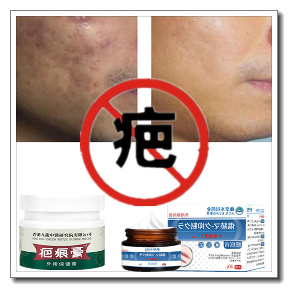 正品祛烟烫烧伤黑色素沉着消除疙瘩修复增生性手术凹凸疤痕印药膏