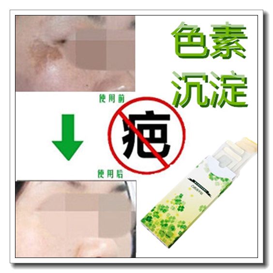 激光去增生凝胶祛剖腹产手术后刀伤疤痕灵清除痘疤膏淡化退黑色素