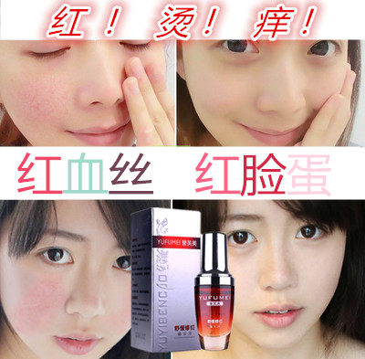 皮肤修复霜增厚角质层缓解发红发热去除鼻翼脸部红血丝男女正品液