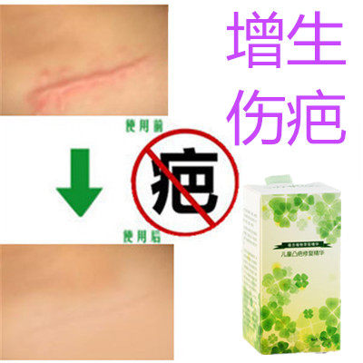 灵疙瘩修复增生性凸起手术剖腹产刀伤巴痕纹身缝针抓伤摔伤撞伤疤