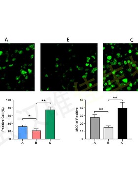免疫组化(IHC)免疫荧光(IF) Tunel 凋亡 细胞实验图片量化分析