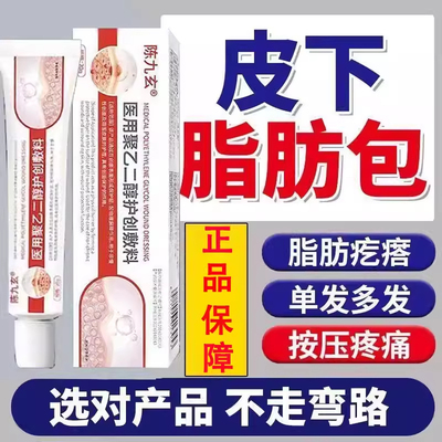 陈九玄改善皮下肿硬块脂肪瘤敷料