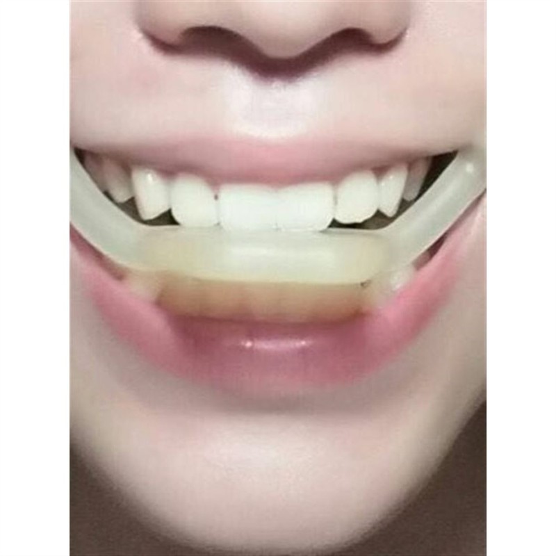 微笑唇训练器微笑训练器微笑矫正器微笑保持器角乘务专业训练神器