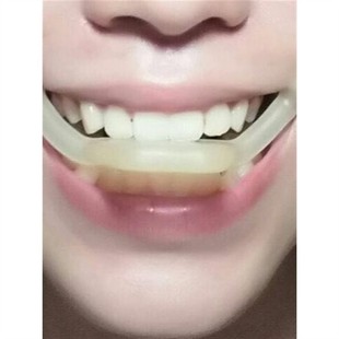 微笑唇训练器微笑训练器微笑矫正器微笑保持器角乘务专业训练神器