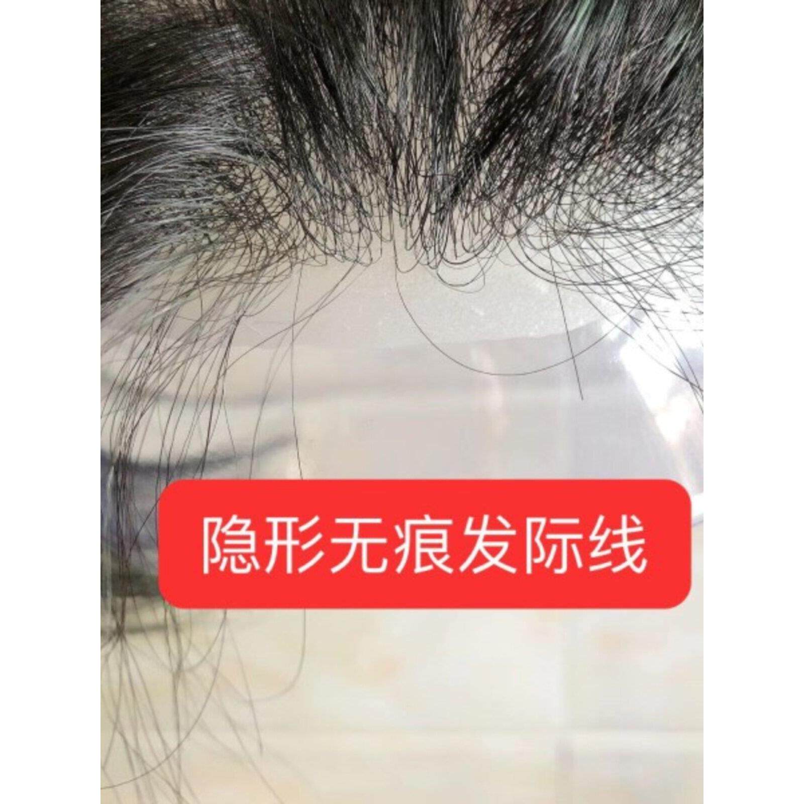 前额发际线假发贴隐形真人发M型头顶补发块生物头皮假刘海补发片