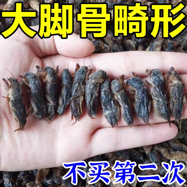 拇指外翻贴脚趾矫正器分大母脚趾头纠正母外翻脚骨软胶贴膏矫正贴