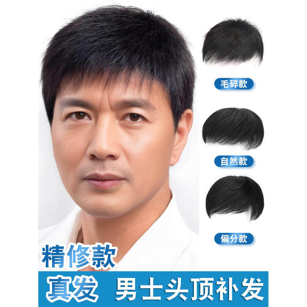 假发男短发真人发男士秃顶前额头顶补发块隐形无痕自然帅气补发片