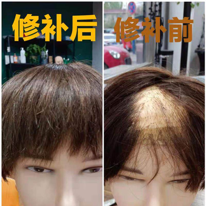 假发片男短发 全真人发 头顶补发片 修补染色修剪