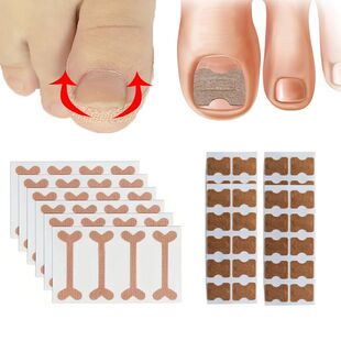 Corrector Nail Patches Toenail Ingrown Correction Stickers