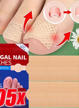 21/105pcs Nail Fungus Patch Waterproof Nail Repair Patch