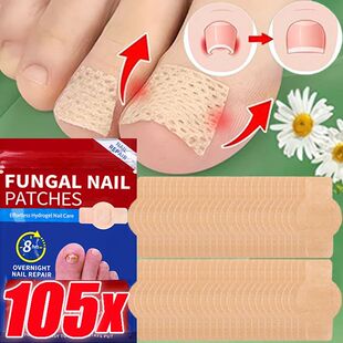 Waterproof Repair Patch Fungus 105pcs Nail