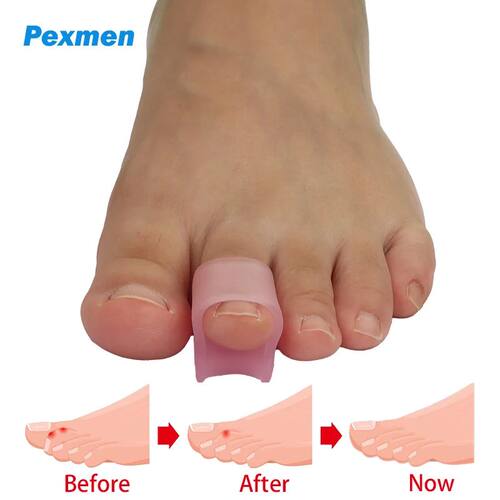 Pexmen 2Pcs Hammertoe Corrector Toe Splints Soft Gel Toe