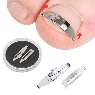 Toe Ingrown Pedicure Nail Buckle Toenails Corrector Foot