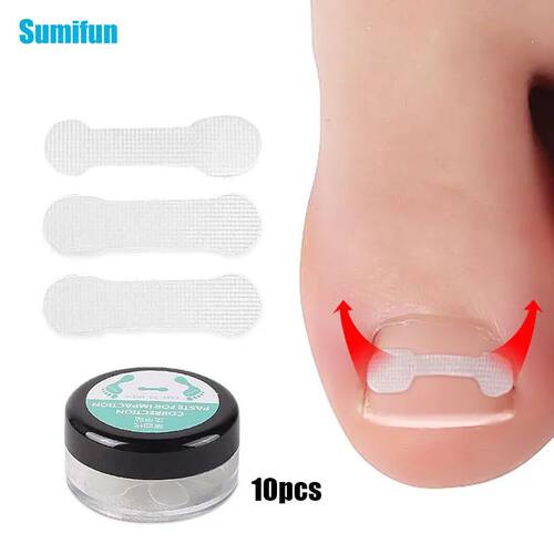 10pc/box Ingrown Toenail Correction Tool Straightening Clip