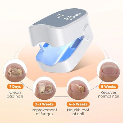 Infrared Nail Fungus atment Tools Remove Fungal Toenail