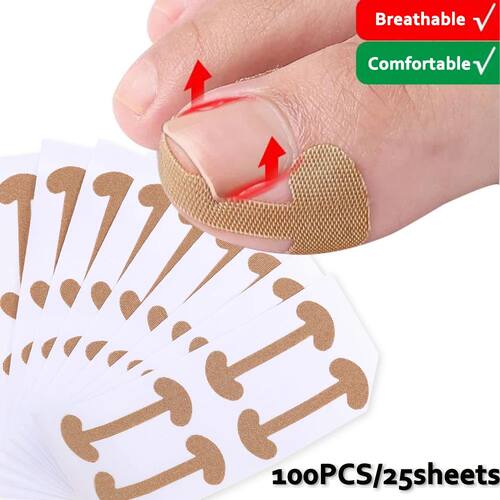 100pcs Ingrown Toenail Correction Strips Lasting Adhesion