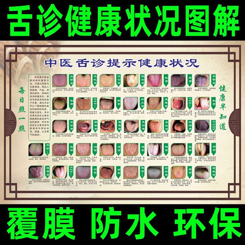 医院挂图 舌诊健康状况对照表图解中医理疗 口腔疾病保健海报贴画 - 实物图