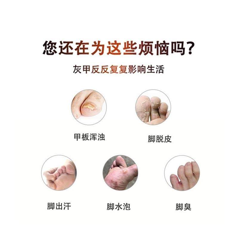 福仙發抑菌粉汗脚脱皮异味脚臭脚痒各种脚买3袋送1袋买5袋送2袋,保健用品,皮肤消毒护理（消）,淘宝优惠券,粉丝福利购,淘宝优惠卷