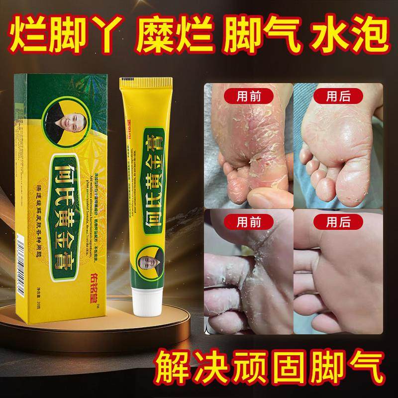 【买2送1】佑铭堂何氏黄金膏脱皮草本抑菌膏江西医好乐佑铭堂正品,保健用品,皮肤消毒护理（消）,淘宝优惠券,粉丝福利购,淘宝优惠卷