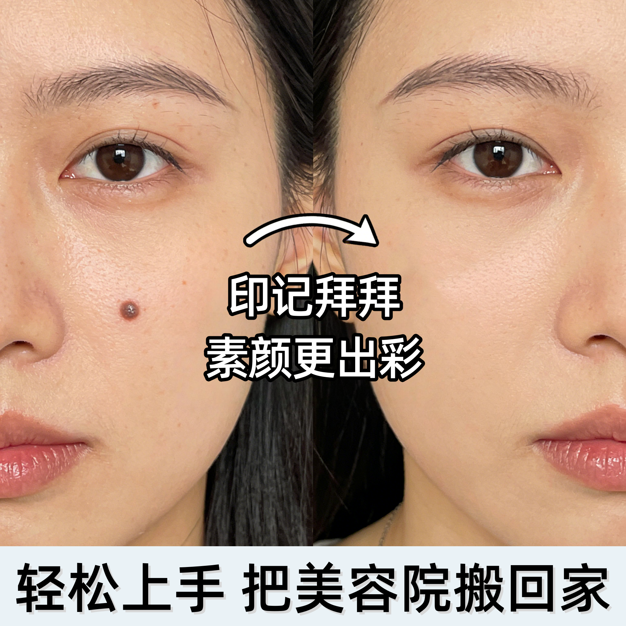 小白点痣笔神器美容院专用脸部点疣扫斑无针头不留痕,美容美体仪器,电子美容仪（非器械）,淘宝优惠券,粉丝福利购,淘宝优惠卷