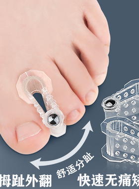 大脚骨突出拇趾外翻矫正器