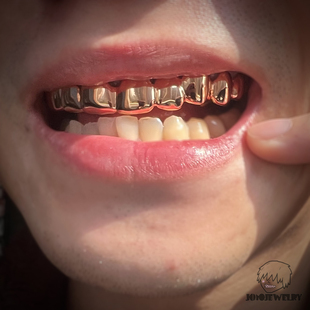 Rose Gold玫瑰金Grillz定制金牙饰嘻哈Hiphop街头美式配饰品珠宝
