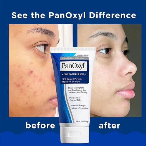 156g PanOxyl 10% Benzoyl Peroxide Pore Deep Cleansing Foam