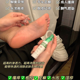 yi儿乐草本脚气喷 清货