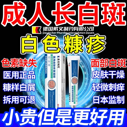 成人儿童面部白色糠疹白斑