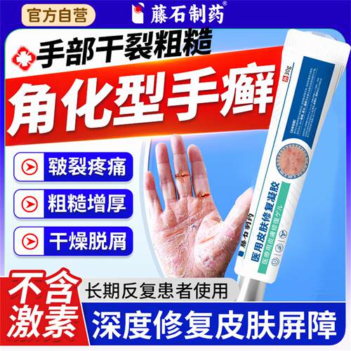 【全网热销】角化型手癣专用膏