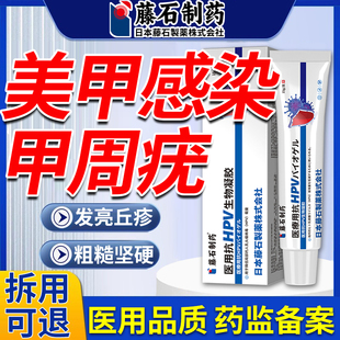 甲周疣药监备案儿童膏手上长硬疙瘩hpv去手指长疣寻常疣手足疣LQ