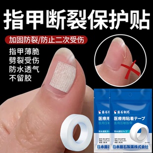 防指甲断裂保护贴医用级护甲套指甲盖受伤边缘裂口保护套创可贴SY