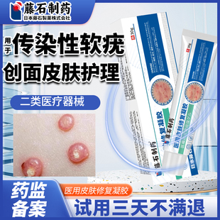 传染性软疣创面皮肤护理儿童成人病毒性水猴子夹子镊子软尤肉粒LJ