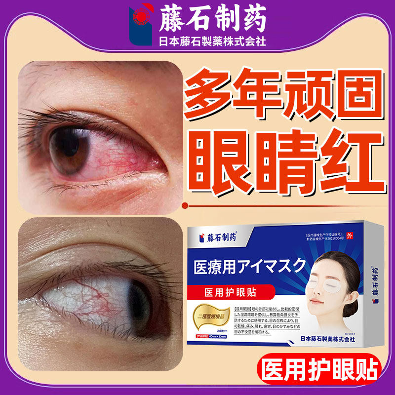 眼睛红眼贴可搭叶黄素眼药水滴眼液官方旗舰店正品红血丝成人去HY