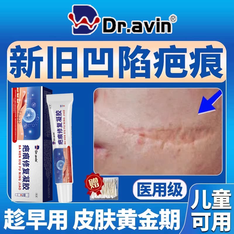 凹陷性疤痕修护医用乳膏